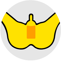 Iライン脱毛