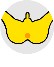 Oライン脱毛